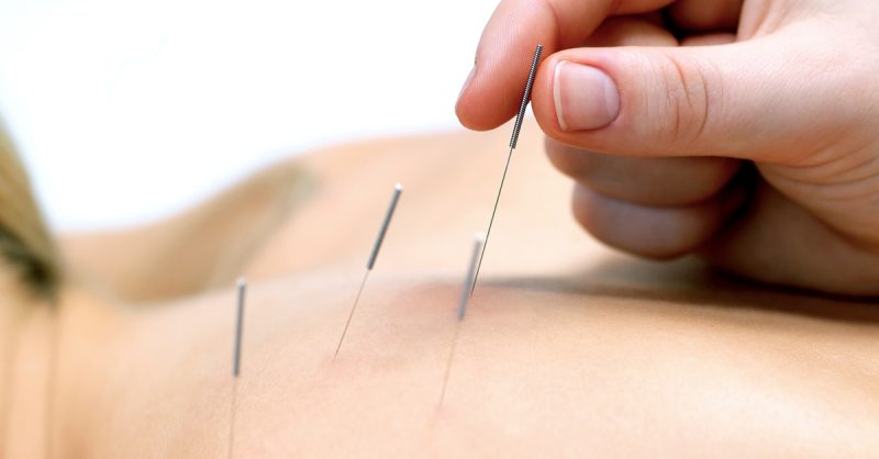 Acupuncture Dublin eUKs.com Special Offers, Deals & Discounts in UK & Ireland