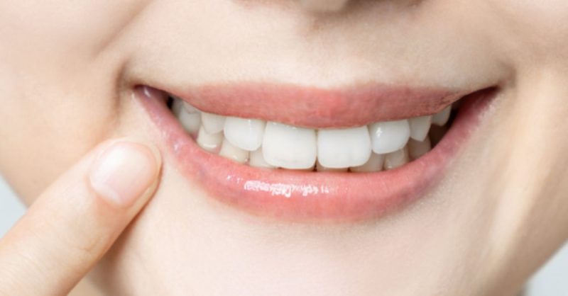 Checkup, Scale, and Polish or Teeth Whitening with In-Home Trays Dublin eUKs.com Special Offers, Deals & Discounts in UK & Ireland 2