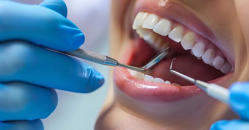 Comprehensive Dental Checkup: Choice of Dental Services Dublin eUKs.com Special Offers, Deals & Discounts in UK & Ireland 3