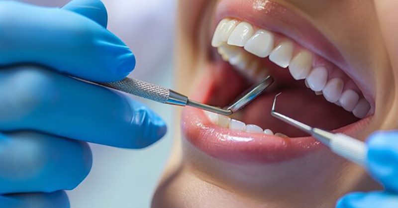 Dental Checkup + Consultation, Examination Optional Scale & Polish Dublin eUKs.com Special Offers, Deals & Discounts in UK & Ireland 2