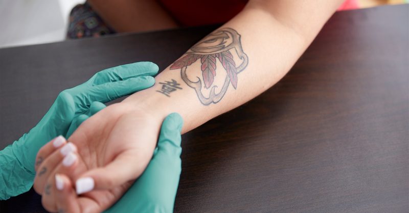 Laser Tattoo Removal Dublin eUKs.com Special Offers, Deals & Discounts in UK & Ireland