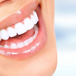One 30 Minute Teeth whitening treatment at Drumcondra Dental Dublin eUKs.com Special Offers, Deals & Discounts in UK & Ireland