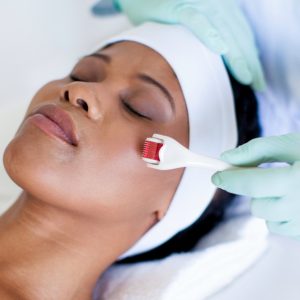 One-Hour Microneedling Facial Dublin eUKs.com Special Offers, Deals & Discounts in UK & Ireland
