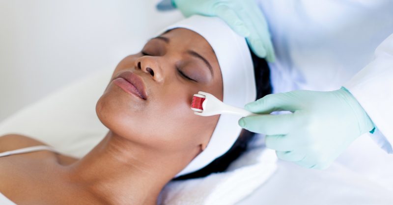 One-Hour Microneedling Facial Dublin eUKs.com Special Offers, Deals & Discounts in UK & Ireland