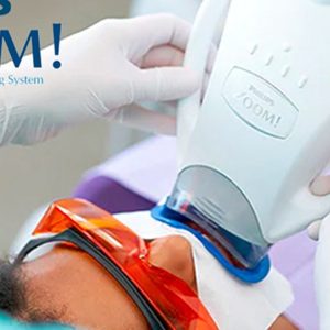 Phillips Zoom Teeth Whitening Dublin eUKs.com Special Offers, Deals & Discounts in UK & Ireland