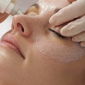 Rejuvenate Your Skin w/ Microdermabrasion Facial w/ Optional Glow Peel Dublin eUKs.com Special Offers, Deals & Discounts in UK & Ireland