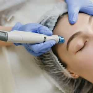 Revitalizing Micro-needling Sessions for Youthful and Firm Skin! Dublin eUKs.com Special Offers, Deals & Discounts in UK & Ireland