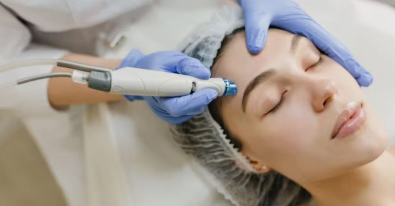 Revitalizing Micro-needling Sessions for Youthful and Firm Skin! Dublin eUKs.com Special Offers, Deals & Discounts in UK & Ireland
