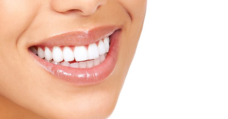 Take Home Whitening Kit, Upper and Lower Tray, and One or Three Syringes at GA Skincare (Up to 40% O Dublin eUKs.com Special Offers, Deals & Discounts in UK & Ireland