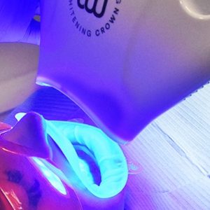 Teeth Whitening – In-Office – Br Dublin eUKs.com Special Offers, Deals & Discounts in UK & Ireland