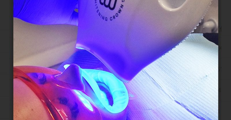 Teeth Whitening – In-Office – Br Dublin eUKs.com Special Offers, Deals & Discounts in UK & Ireland